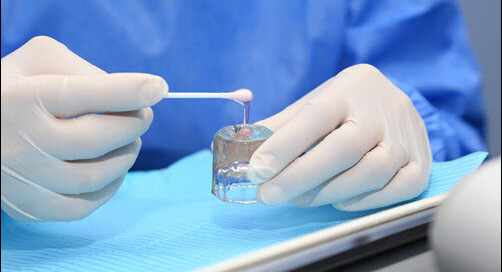 Fluoride