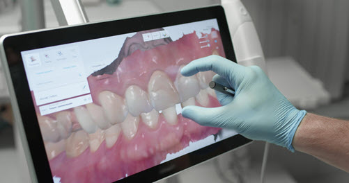 digital dental scans