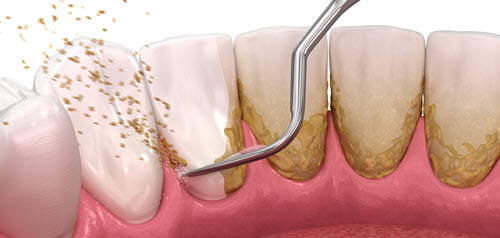 periodontics