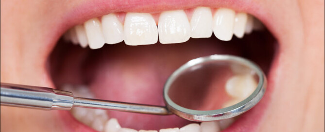 Dental Exam